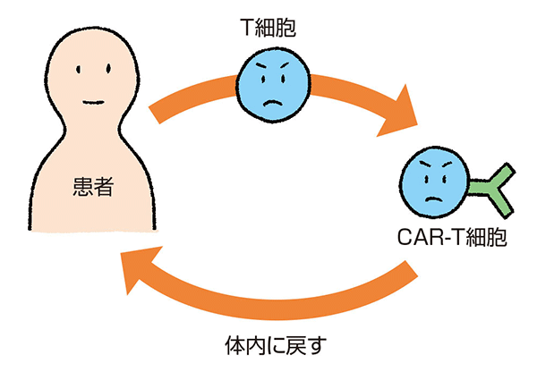 キメラ抗原受容体で免疫機能up Car T細胞療法 医療法人輝鳳会クリニック Nk療法 Inkt療法によるがん治療